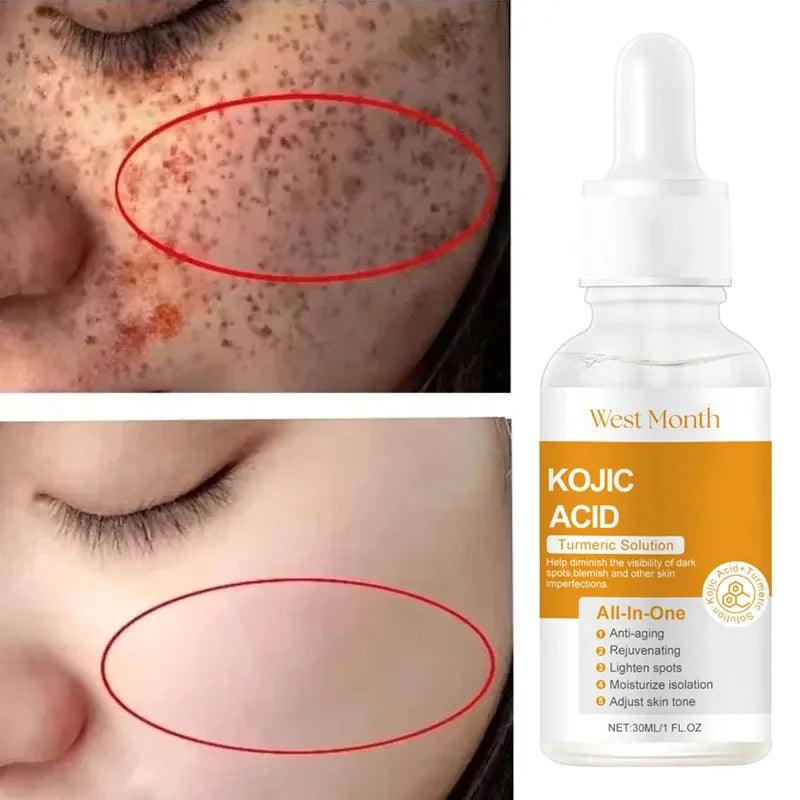 Kojic Acid Whitening Serum